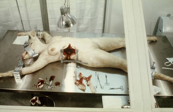 operating-room 1973